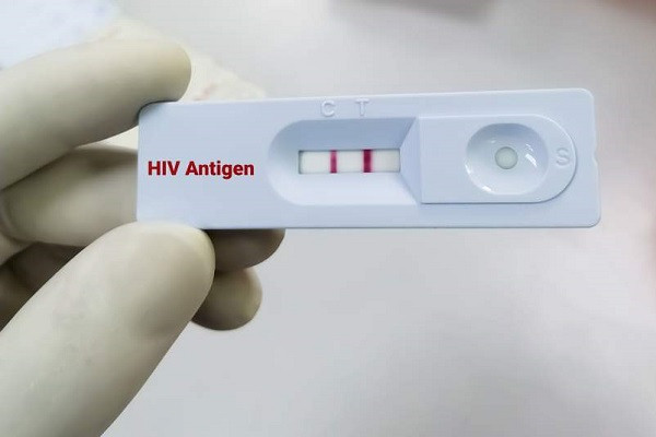 HIV testing device (symbolic picture)