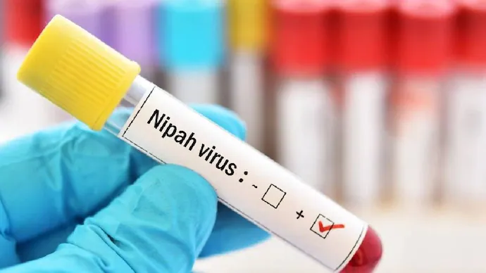 Nipah Virus (symbolic picture)