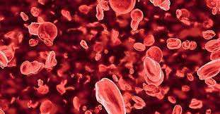 Inherited blood disorders in children, thalassemia in kids,